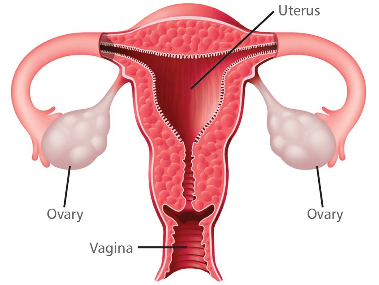petefészekrák vagy endometriózis