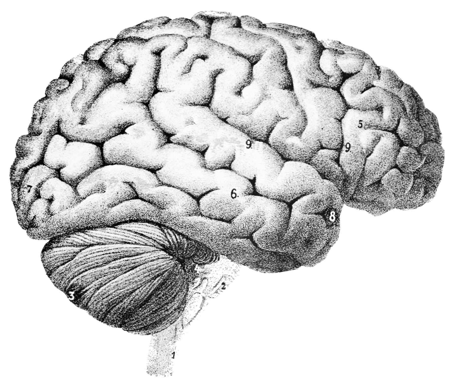 Milyen tünetei és szövődményei lehetnek az agyi áttéteknek..