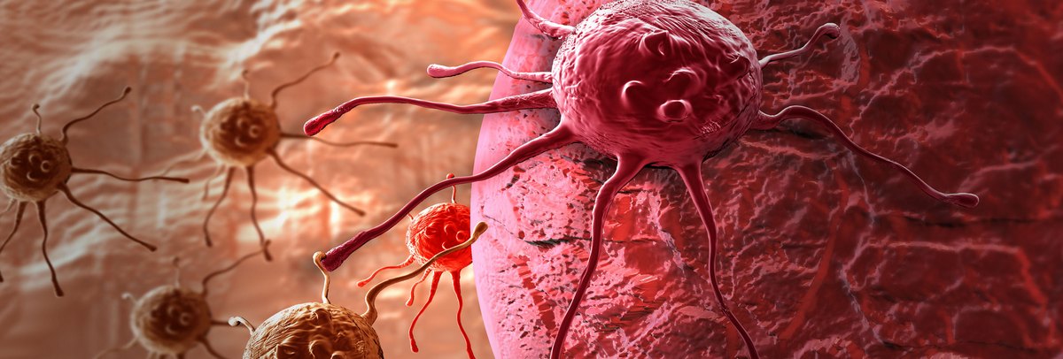 A rák stádiumai - Áttétes rák meghatározása