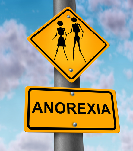 anorexiás fogyás igénye
