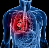 tüdő tünetei és kezelése